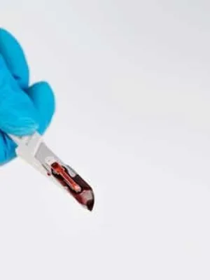 Are You at Risk for Diabetes? Early Detection and Prevention Strategies for 2025 - Cover Image