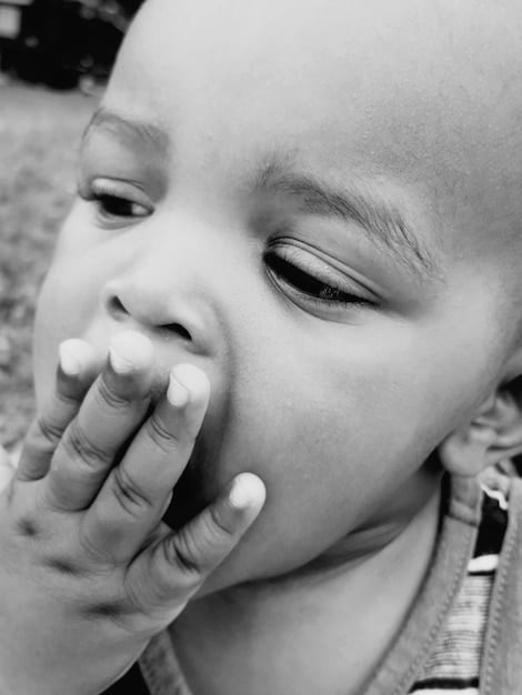 A close-up photo of a malnourished child in Yemen being cared for at a medical clinic, highlighting the impact of the crisis on vulnerable populations.